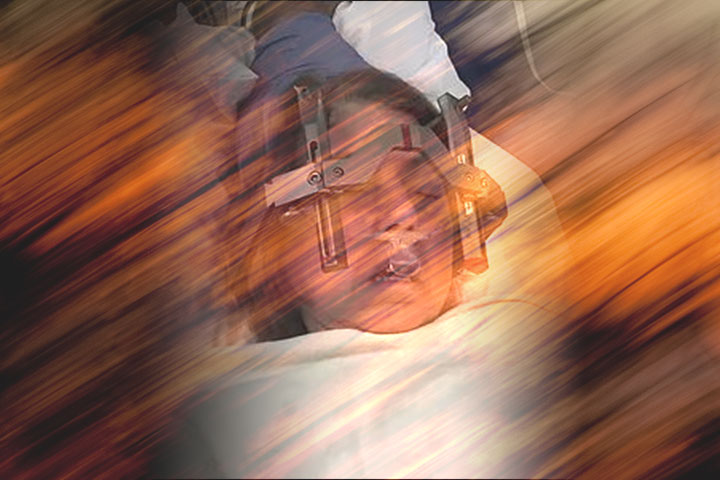 A woman recovering from stroke